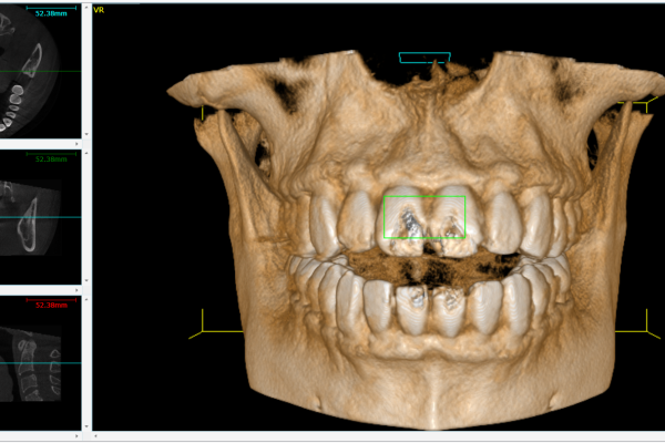 CBCT_image_02