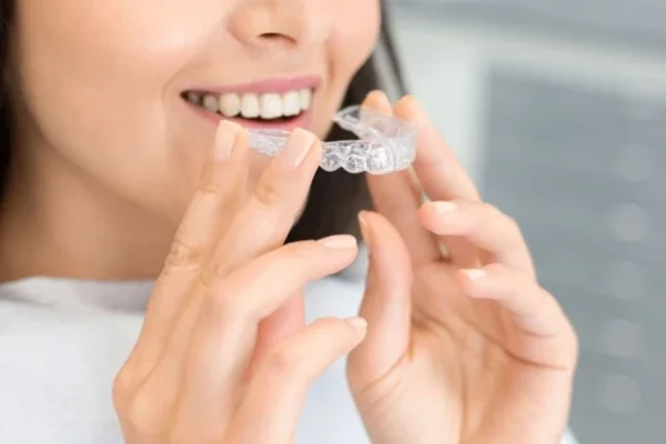 Invisible-Orthodontics-640x480